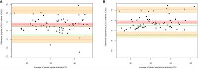 Arterial pCO2 prediction using saphenous pCO2 in healthy mechanically ventilated dogs